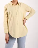 تونیک راه راه OppsiR00474 - Image 4